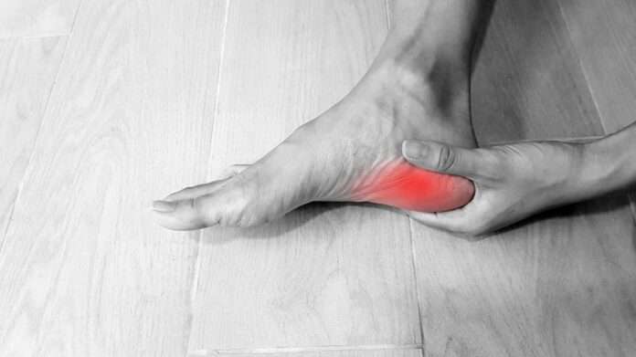 Plantar Fasciitis