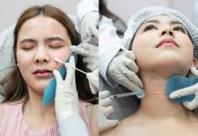 Juvelook Aftercare Tips For Steady Skin Support