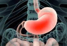 Hypochlorhydria: Understanding the Real Impact of Low Stomach Acid