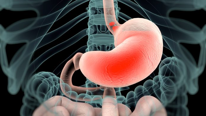 Understanding the Real Impact of Low Stomach Acid
